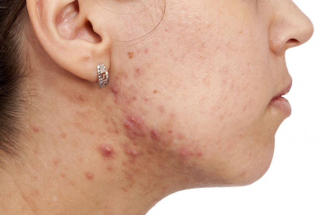 address skin health with chinese medicine